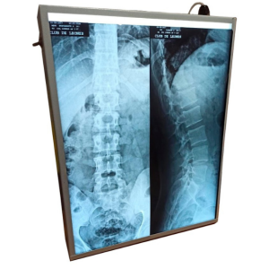 Negatoscopio con tecnología LED